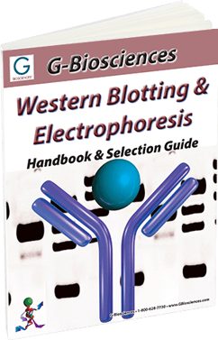 Western Blotting and Protein Electrophoresis